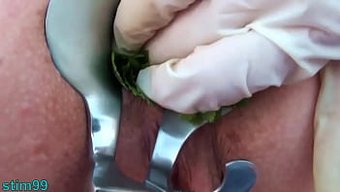 Speculum A...